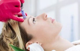 یک خانم در حال انجام میکرونیدلینگ بر روی پوست صورت در ناحیه پیشانی است و پزشکی با دستکش قرمز رنگ و دستگاه درماپن در حال جوانسازی است موی خانم طلایی بوده و ریلکس روی تخت خوابیده است