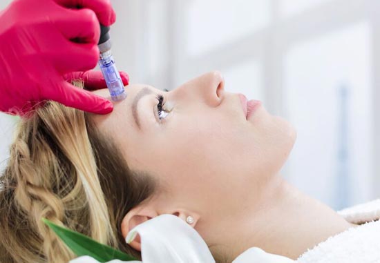 یک خانم در حال انجام میکرونیدلینگ بر روی پوست صورت در ناحیه پیشانی است و پزشکی با دستکش قرمز رنگ و دستگاه درماپن در حال جوانسازی است موی خانم طلایی بوده و ریلکس روی تخت خوابیده است