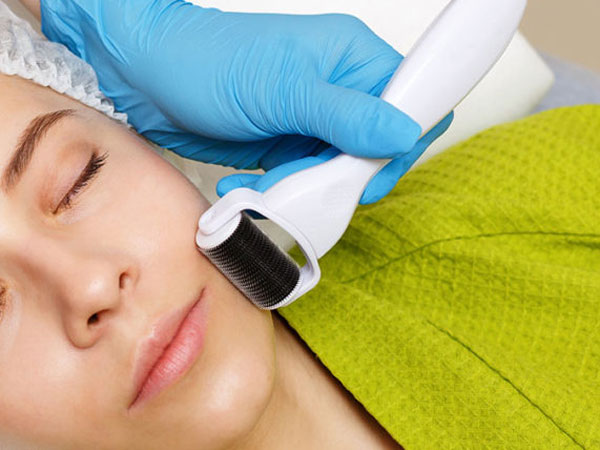 یک خانم در حال انجام میکرونیدلینگ بر روی پوست صورت در ناحیه گونه است و پزشکی با دستکش آبی رنگ و دستگاه درمارولر در حال جوانسازی است . بیمار ریلکس روی تخت دراز کشیده است
