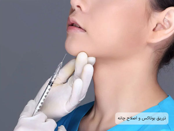 تصویری از یک خانم در حال تزریق بوتاکس صورت در ناحیه چانه توسط پزشک . پیزاهن بیمار آبی رنگ و دستکش های پزشک سفید رنگ می باشد . همچنین سرنگ در تصویر کاملا نمایان است