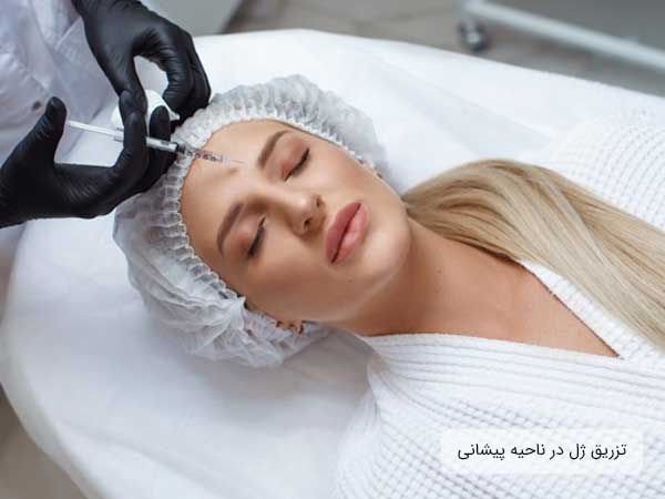 تصویر یک خانم خوابیده به پشت بر روی تخت مطب در حال تزریق ژل در ناحیه پیشانی خود توسط پزشک است . دستکش دکتر مشکی و زمینه تصویر سفید می باشد . همچنین سرنگ کاملا در تصویر نمایان است