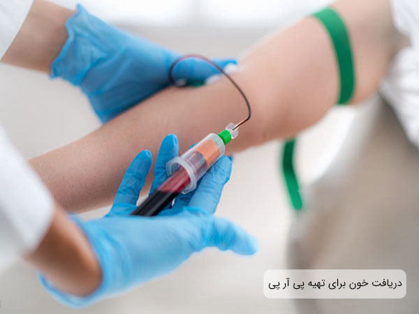 تصویری از یک فرد در حال خون دادن به نمونه بردار برای انجام روش پی آر پی. دستکش های نمونه بردار آبی و زمینه تصویر روشن می باشد 