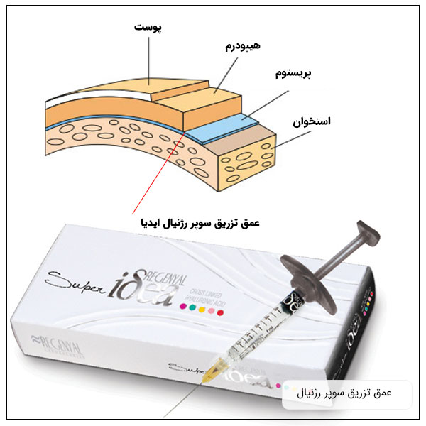 تصویر یک بسته ژل سوپر آیدیا به همراه توضیح عمق تزریق آن در پوست و گوشت زیرجلدی محل هدف تزریق