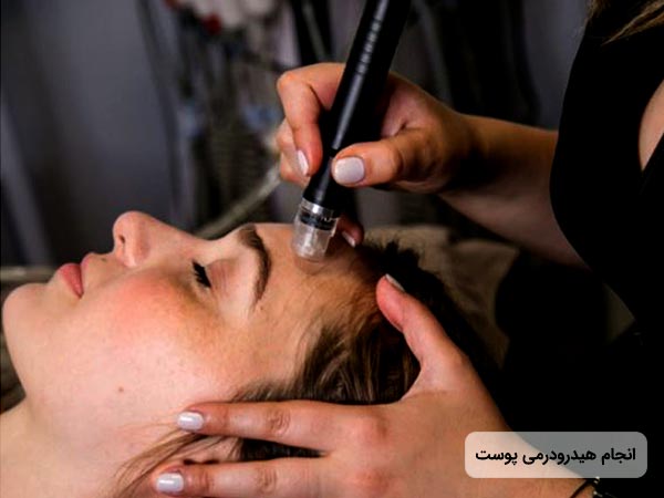 پزشک در حال جوانسازي پوست صورت خانم جوان با استفاده از روش هيدرودرم ابريژن مي باشد.