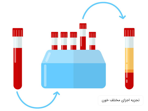 تصویر روند تجزیه خون به قسمتهای مختلف به وسیله دستگاه سانتریفیوژ . زمینه تصویر سفید می باشد و در فراورده اصلی پلاسمای خون ظاهر شده است با رنگ زد