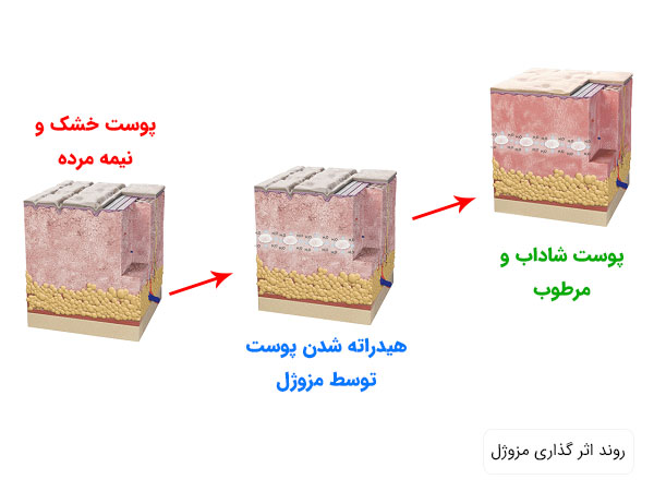 روند اثرگذاری مزو ژل در سه مرحله بر روی پوست در تصویر نمایان می باشد