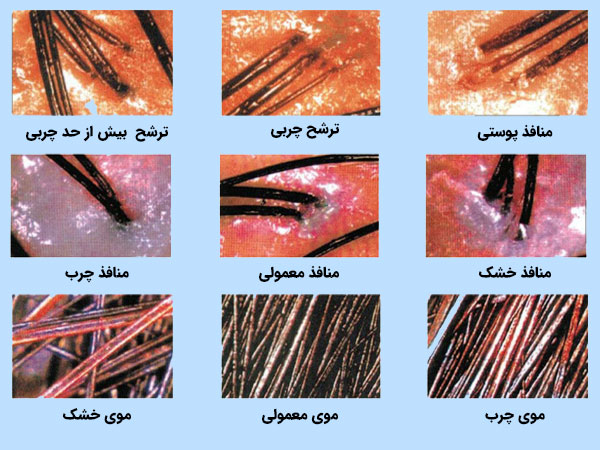 نمایش انواع ضایعات پوستی در خروجی اسکنر و آنالیزور پوست کلین کره