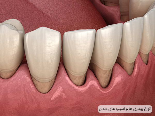 آسیب ها و مشکلات دندان