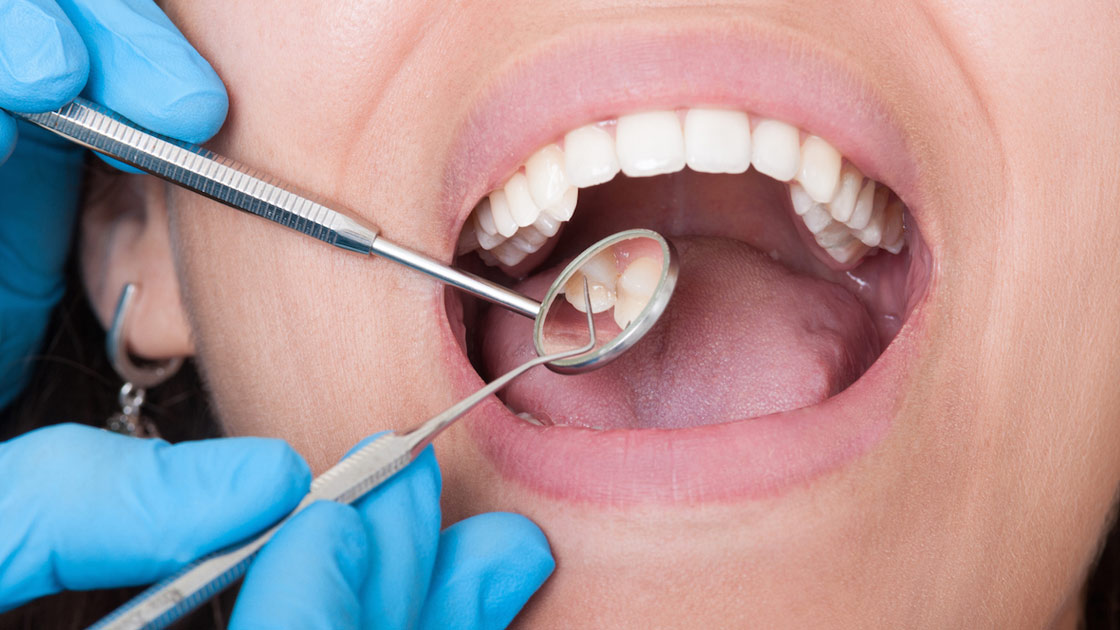 آشنایی با آسیب ها و روش های درمان بیماری های دهان و دندان