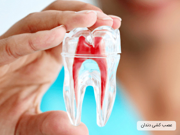 عصب کشی و روت کانال تراپی دندان