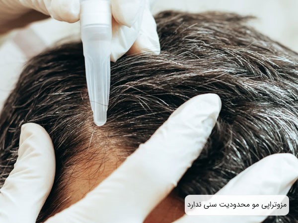مزوتراپی مو؛ روشی درمانی برای ریزش مو بدون محدودیت سنی