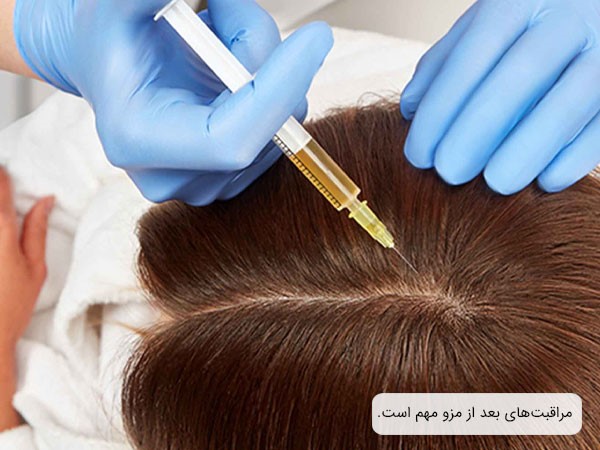 مراقبت‌های بعد از مزوتراپی مو؛ عوامل موثر بر کسب نتیجه دلخواه از این روش درمانی