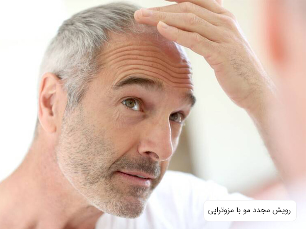 يک مرد ميانسال که در حال بررسی وضعيت مو هاي خود است.