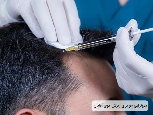 انجام مزوتراپی مو روی سر يک آقا توسط پزشک متخصص.