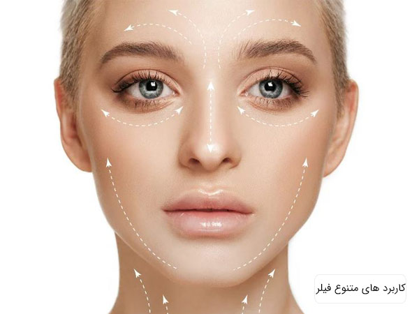 نقاط مختلف و کاربرد های گوناگون تزريق فيلر روی صورت يک خانم نمايش داده شده است.