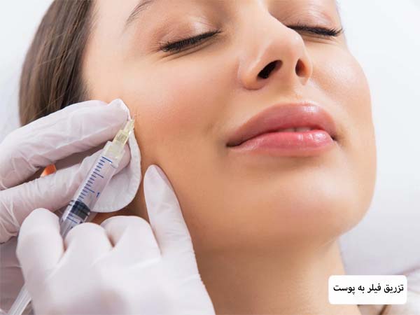 تزریق فیلر یه پوست صورت یک خانم جوان توسط متخصص.