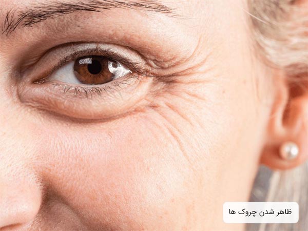 چين و چروک های ريز يا خطوط پنجه کلاغی اطراف چشم يک خانم ميانسال با چشمان قهوه ای رنگ.
