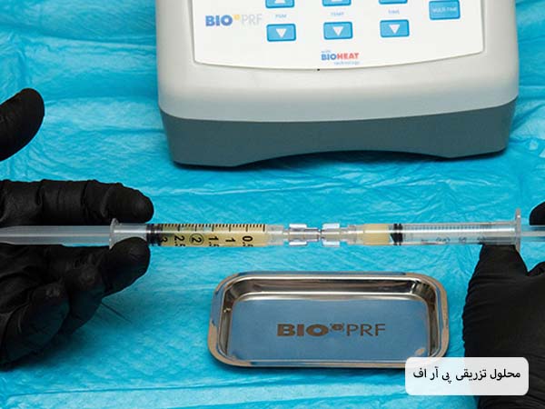 استخراج محلول پی آر پی از یک سرنگ بوسیله متخصص روی یک پارچه آبی رنگ.