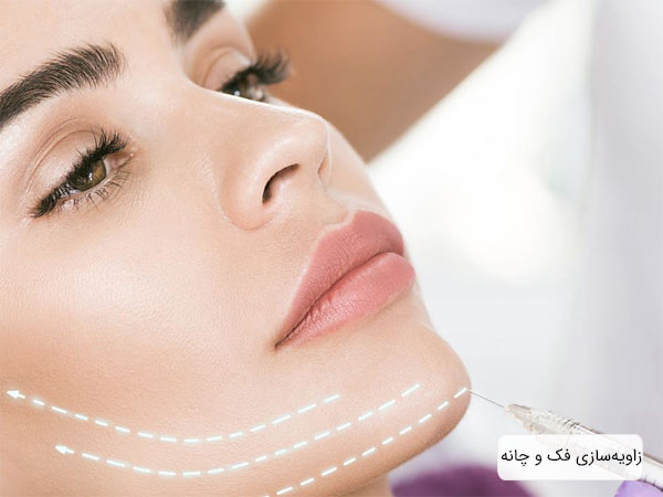 تزريق فيلر براي زاويه سازي فک يک خانم جوان.