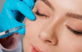 تزریق فیلر به صورت یک خانم جوان توسط پزشک